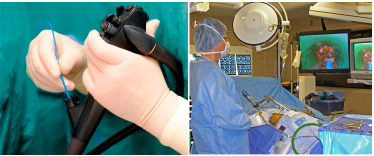 Neurosurgeon Shlomo Davidovich during disc herniation surgery Neurosurgeon Shlomo Davidovich during disc herniation surgery
